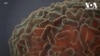 16x9 Image