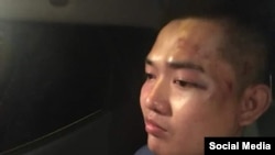 Ca sĩ Nguyễn Tín sau khi bị đánh đêm 15/8/2018. Facebook Dương Đại Triều Lâm.